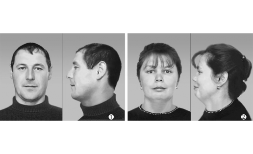 Пермь башҡорттарының антропологик типтары: 1 — понтий тибы; 2 — субурал тибы;