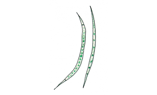 Анкистродесмус длиннейший (Ankistrodesmus longissimus)